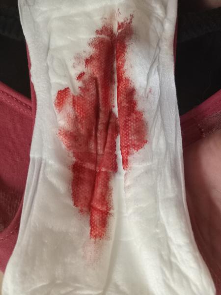 p1