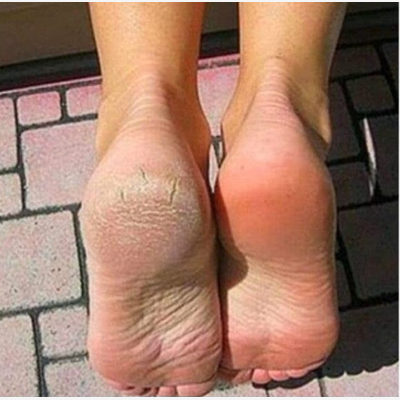  Soins bien être du pied pour femme