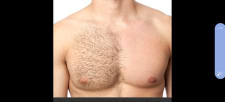 épilation orientale